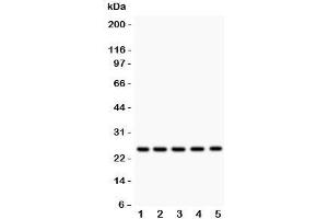 Western blot testing of HSP27 antibody and Lane 1:  rat NRK;  2: human HeLa;  3: (h) A549;  4: (h) COLO320;  5: (h) HEPG2 lysate. (HSP27 Antikörper  (AA 1-205))