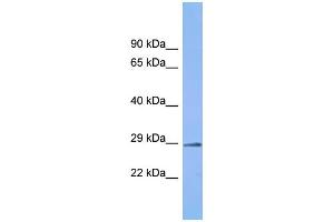 Host: Rabbit Target Name: C6orf203 Sample Type: Fetal Kidney lysates Antibody Dilution: 1. (C6ORF203 Antikörper  (C-Term))