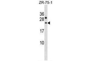 CCDC140 Antibody (N-term) western blot analysis in ZR-75-1 cell line lysates (35µg/lane). (CCDC140 Antikörper  (N-Term))