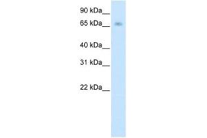 KBTBD10 antibody (20R-1205) used at 0. (Kelch-like protein 41 (KLHL41) (N-Term) Antikörper)