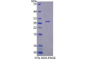 Image no. 1 for SH2B Adaptor Protein 3 (SH2B3) (AA 225-447) protein (His tag) (ABIN6238394) (SH2B3 Protein (AA 225-447) (His tag))