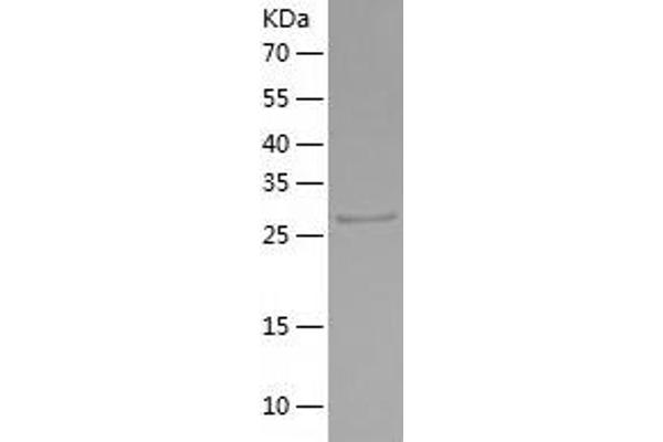 ETS1 Protein (AA 1-272) (His tag)