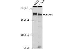 Western blot analysis of extracts of various cell lines, using  Rabbit mAb (ABIN7265749) at 1:1000 dilution. (ATAD2 Antikörper)