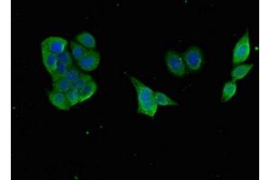 Immunofluorescent analysis of PC-3 cells using ABIN7153517 at dilution of 1:100 and Alexa Fluor 488-congugated AffiniPure Goat Anti-Rabbit IgG(H+L) (GABARAPL1 Antikörper  (AA 1-117))