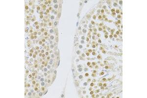 Immunohistochemistry of paraffin-embedded rat testis using SLC39A7 antibody (ABIN5971725) at dilution of 1/100 (40x lens). (SLC39A7 Antikörper)