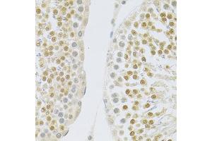 Immunohistochemistry of paraffin-embedded rat testis using SLC39A7 antibody (ABIN5971725) at dilution of 1/100 (40x lens).