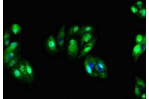 Immunofluorescent analysis of HepG2 cells using ABIN7171195 at dilution of 1:100 and Alexa Fluor 488-congugated AffiniPure Goat Anti-Rabbit IgG(H+L) (SDC4 Antikörper  (AA 19-145))