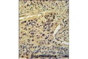 Immunohistochemistry (Paraffin-embedded Sections) (IHC (p)) image for anti-TAF2 RNA Polymerase II, TATA Box Binding Protein (TBP)-Associated Factor, 150kDa (TAF2) (AA 1152-1180), (C-Term) antibody (ABIN653923)