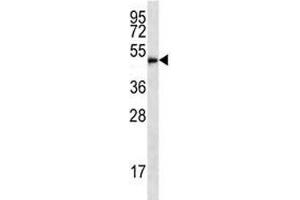 HDAC3 antibody western blot analysis in HL-60 lysate (HDAC3 Antikörper  (AA 383-412))