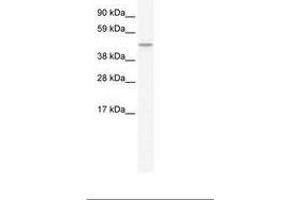 Image no. 1 for anti-Transmembrane Protein 108 (TMEM108) (C-Term) antibody (ABIN203178) (TMEM108 Antikörper  (C-Term))