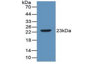 Western blot analysis of recombinant Mouse IL2. (IL-2 Antikörper  (AA 10-169))