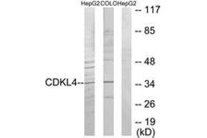 Western blot analysis of extracts from HepG2/COLO205 cells, using CDKL4 Antibody. (CDKL4 Antikörper  (AA 266-315))