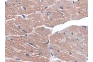 Immunohistochemistry (IHC) image for anti-Integrin, alpha 3 (ITGA3) (AA 33-236) antibody (ABIN7433390)