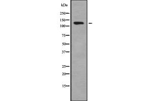 Western blot analysis of A Cyclase I using COLO205 whole cell lysates (ADCY1 Antikörper  (Internal Region))