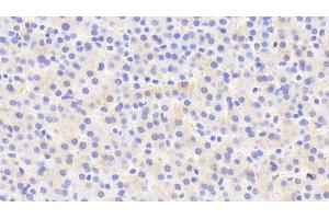 Detection of IDS in Human Liver Tissue using Polyclonal Antibody to Iduronate-2-Sulfatase (IDS) (IDS Antikörper  (AA 95-289))
