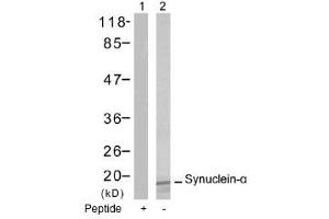 Image no. 1 for anti-Synuclein, alpha (SNCA) (Tyr125) antibody (ABIN197503) (SNCA Antikörper  (Tyr125))