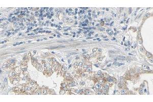 ABIN6277958 at 1/100 staining Human prostate tissue by IHC-P. (GNB2 Antikörper  (C-Term))