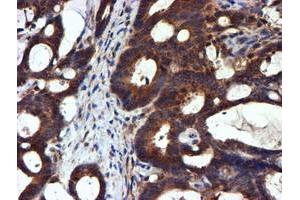 Image no. 4 for anti-NADH Dehydrogenase (Ubiquinone) Complex I, Assembly Factor 7 (NDUFAF7) antibody (ABIN1499667) (NDUFAF7 Antikörper)