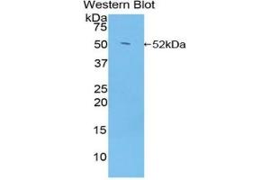 Western blot analysis of the recombinant protein. (Glucocorticoid Receptor Antikörper  (AA 564-733))