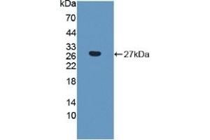 Detection of Recombinant CTHRC1, Human using Polyclonal Antibody to Collagen Triple Helix Repeat Containing Protein 1 (CTHRC1) (CTHRC1 Antikörper  (AA 31-243))