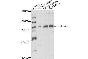 Western blot analysis of extracts of various cell lines, using SPATA7 antibody (ABIN6292521) at 1:3000 dilution.
