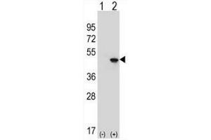 Western blot analysis of EIF4A2 (arrow) using rabbit polyclonal EIF4A2 Antibody (C-term) . (EIF4A2 Antikörper  (C-Term))