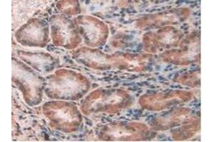 IHC-P analysis of Human Kidney Tissue, with DAB staining. (CLIC1 Antikörper  (AA 79-241))