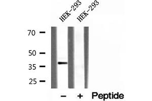 Western blot analysis of extracts of HEK-293 cells, using CLTA antibody. (CLTA Antikörper)