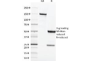 SDS-PAGE Analysis Purified CD71 Mouse Monoclonal Antibody (TFRC/1818). (Transferrin Receptor Antikörper  (AA 94-212))