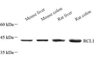 Western blot analysis of RCL1 (ABIN7075482) at dilution of 1: 500 (RCL1 Antikörper)