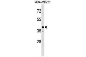 TAS2R31 Antibody (C-term) western blot analysis in MDA-MB231 cell line lysates (35µg/lane).