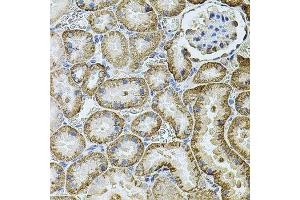 Immunohistochemistry (Paraffin-embedded Sections) (IHC (p)) image for anti-Cadherin-16 (CDH16) (AA 19-230) antibody (ABIN6138291)