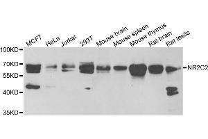 Western blot analysis of extracts of various cell lines, using NR2C2 antibody (ABIN5973822) at 1/1000 dilution. (TR4 Antikörper)