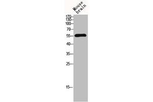 Western blot analysis of mouse-brain lysis using MMP-13 antibody. (MMP13 Antikörper  (N-Term))
