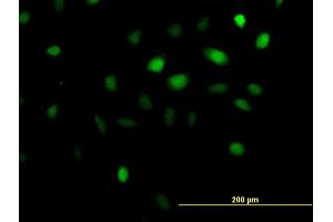 Immunofluorescence of purified MaxPab antibody to ANKRD1 on HeLa cell. (ANKRD1 Antikörper  (AA 1-319))