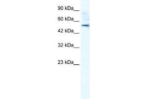 SMPDL3B antibody used at 1 ug/ml to detect target protein. (SMPDL3B Antikörper  (N-Term))