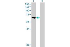 Western Blotting (WB) image for anti-Transforming Growth Factor beta Regulator 4 (TBRG4) (AA 1-631) antibody (ABIN522700)