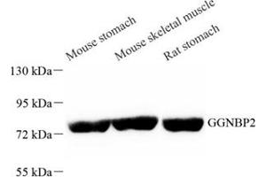 Western blot analysis of GGNBP2 (ABIN7074017) at dilution of 1: 1000