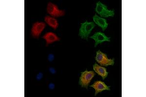 ABIN7094259 and ABIN7098306 staining HepG2 cells by IF/ICC.