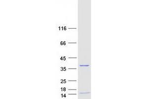 Western Blotting (WB) image for Replication Protein A4, 30kDa (RPA4) protein (Myc-DYKDDDDK Tag) (ABIN2731117)