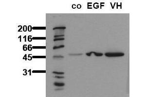 Western Blotting (WB) image for anti-Glycogen Synthase Kinase 3 alpha (GSK3a) (pSer21) antibody (ABIN126804) (GSK3 alpha Antikörper  (pSer21))