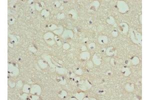 Immunohistochemistry of paraffin-embedded human brain tissue using ABIN7154206 at dilution of 1:100 (PYGB Antikörper  (AA 6-843))