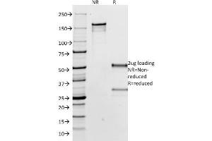 SDS-PAGE Analysis Purified IgG Mouse Monoclonal Antibody (IG266). (IGHG Antikörper  (CF®488A))