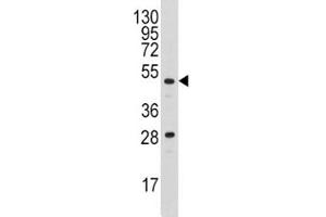 Western blot analysis of Urokinase antibody and A2058 lysate (PLAU Antikörper  (AA 60-90))