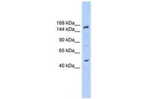 Image no. 1 for anti-SNF2 Histone Linker PHD RING Helicase, E3 Ubiquitin Protein Ligase (SHPRH) (AA 251-300) antibody (ABIN6742697) (SHPRH Antikörper  (AA 251-300))