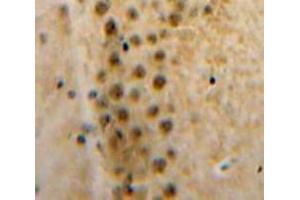 Used in DAB staining on fromalin fixed paraffin-embedded Brain tissue (Axin Antikörper  (AA 653-862))