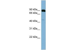 WB Suggested Anti-PSEN1  Antibody Titration: 0. (Presenilin 1 Antikörper  (N-Term))