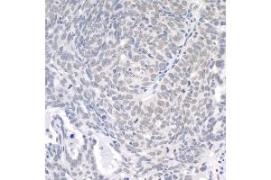 anti-Ubiquitin Specific Peptidase 1 (USP1) (AA 450-500) antibody