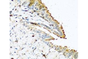 Immunohistochemistry (Paraffin-embedded Sections) (IHC (p)) image for anti-Ribonuclease, RNase A Family, 13 (Non-Active) (RNASE13) antibody (ABIN7255399)