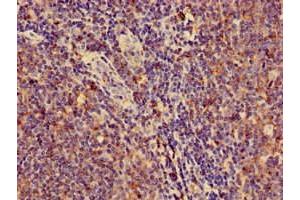 Immunohistochemistry of paraffin-embedded human lymph node tissue using ABIN7155625 at dilution of 1:100 (HLA-C Antikörper  (AA 25-308))